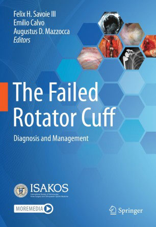Chapter to ISAKOS Book, The Failed Rotator Cuff